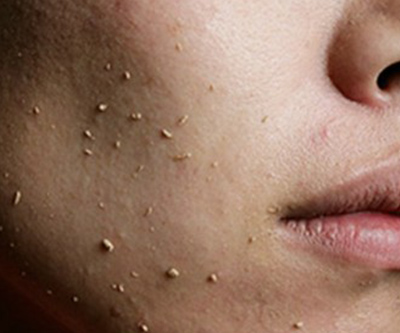 sunscreen pilling reddit