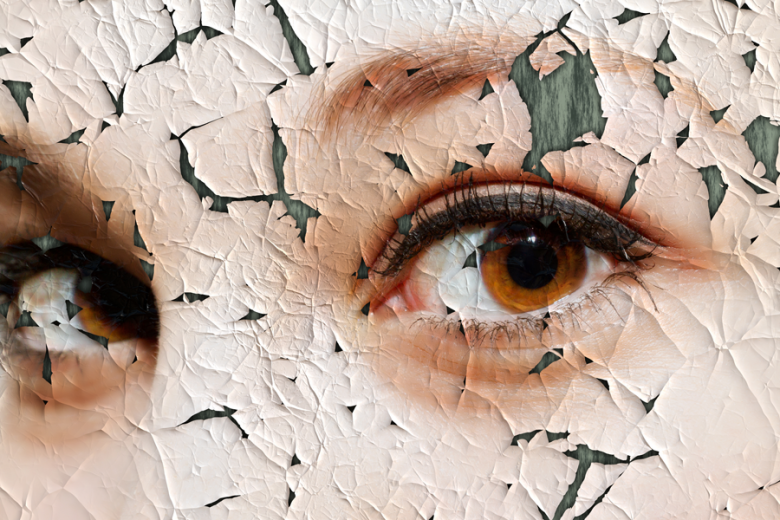 Anti-aging and skin correction blog What You Need To Know About Skin Peels - SPA+CLINIC