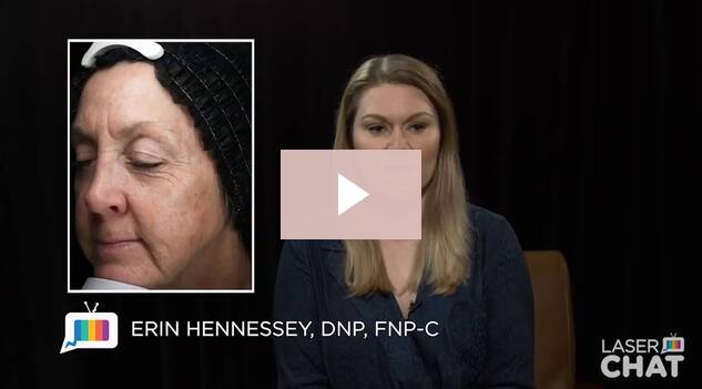 Log of The New Sciton LaserChat – Coming Soon